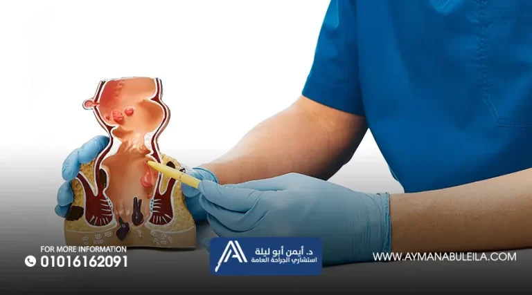 ما-هي-عملية-الناسور-العصعصي-بالليزر-1-768x427 وجع العصعص وعلاجه | الأسباب وأحدث طرق العلاج الفعالة