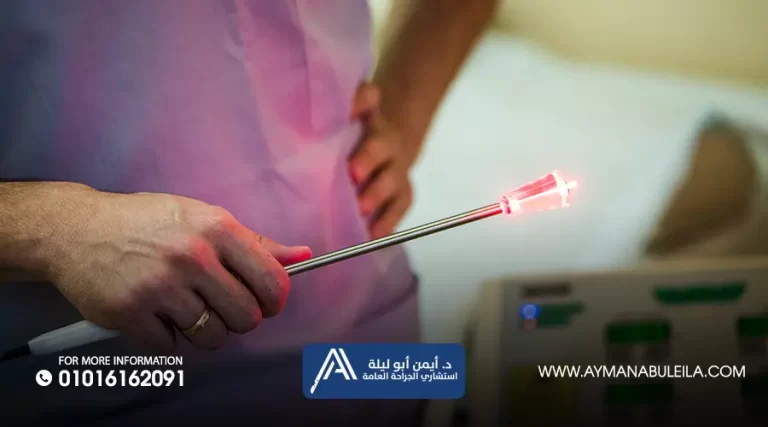علاج الناسور بالليزر في مصر | تقنية حديثة ونتائج مضمونة