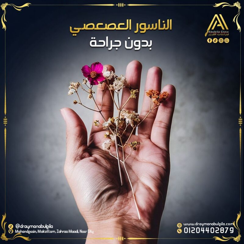 الناسور العصعصي بدون جراحة – علاج بالليزر مع د. أيمن أبو ليلة