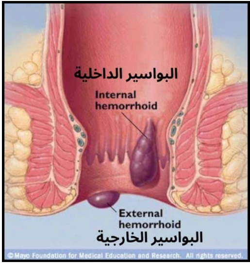 أفضل دكتور لبالليزر في مصر