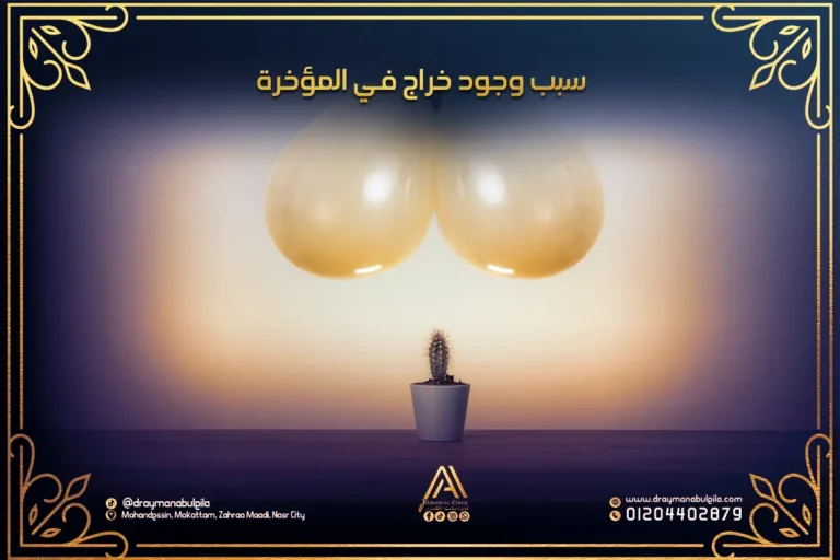 سبب وجود خراج في المؤخرة وأهم طرق العلاج | دكتور أيمن أبو ليله