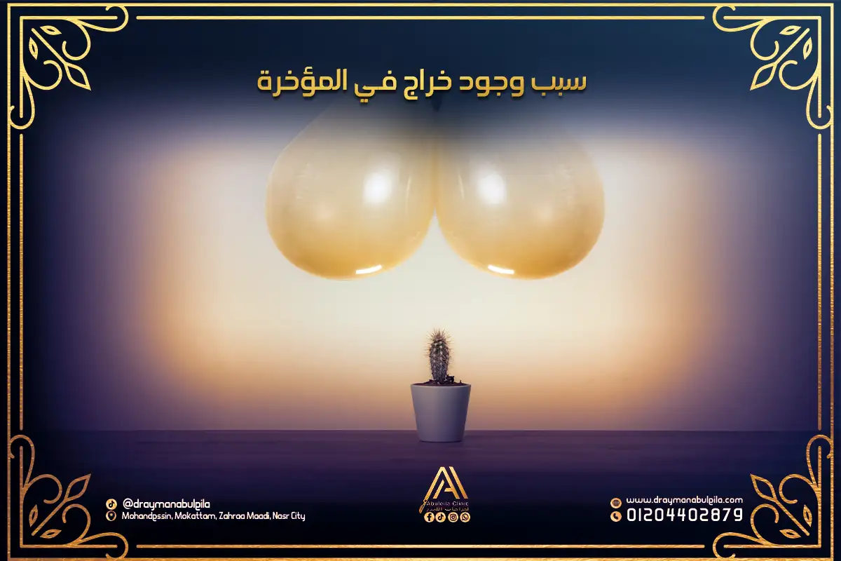 سبب وجود خراج في المؤخرة وأهم طرق العلاج | دكتور أيمن أبو ليله