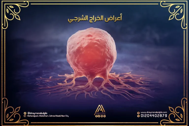 أعراض الخراج الشرجي | الأسباب وطرق العلاج مع دكتور أيمن أبو ليله