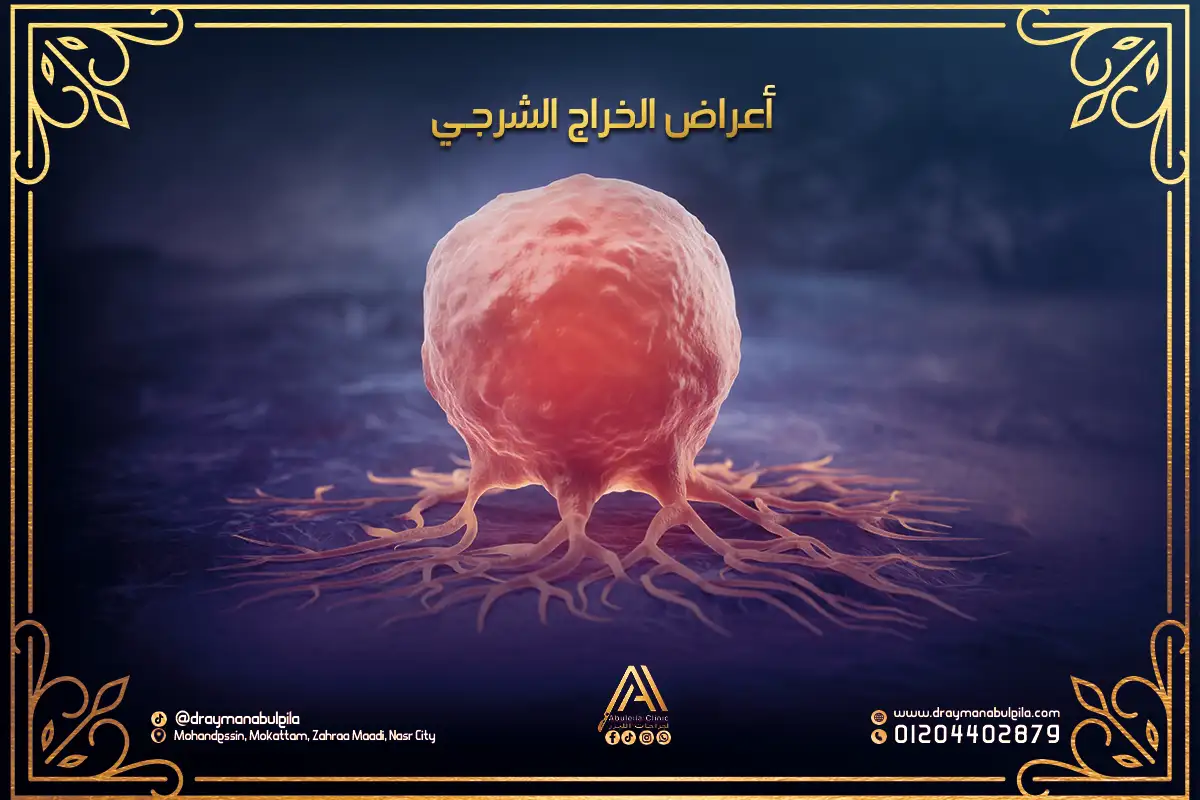 أعراض الخراج الشرجي | الأسباب وطرق العلاج مع دكتور أيمن أبو ليله