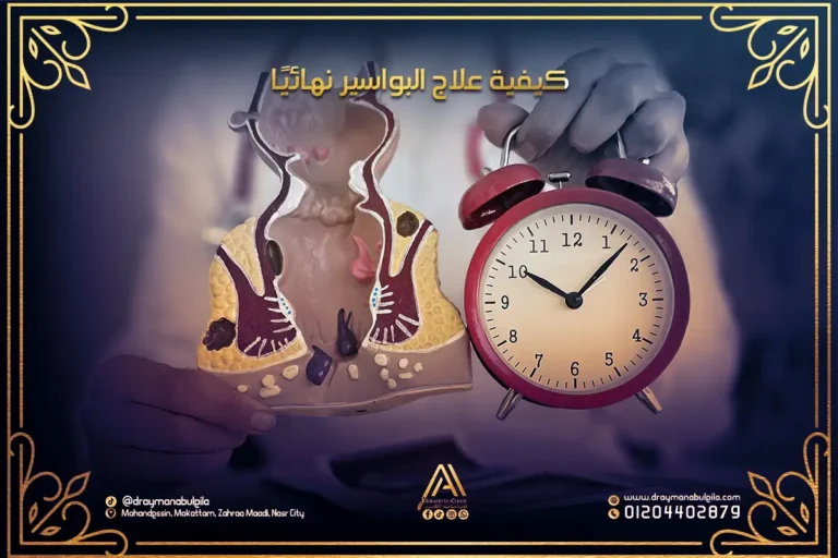 كيفية علاج البواسير بأحدث الطرق الطبية والليزر|أيمن أبو ليلة