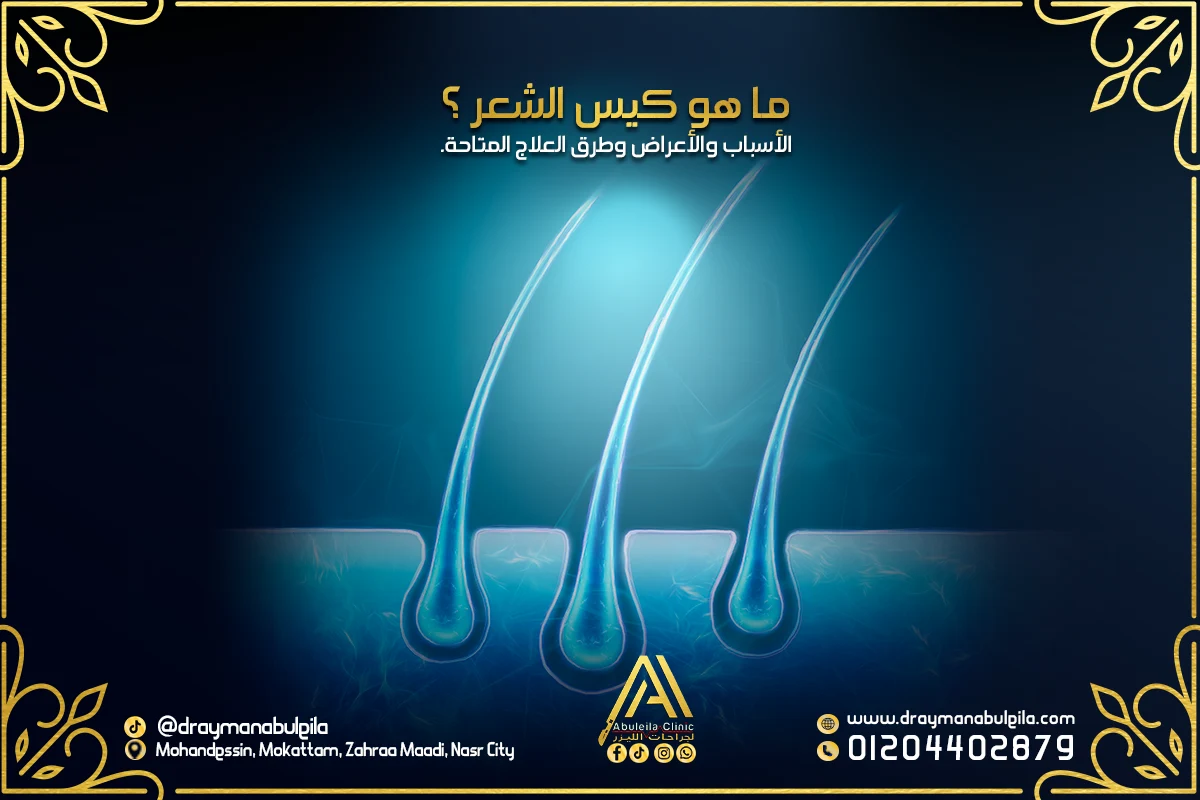 ما هو كيس الشعر ؟الأسباب والأعراض وطرق العلاج المتاحة