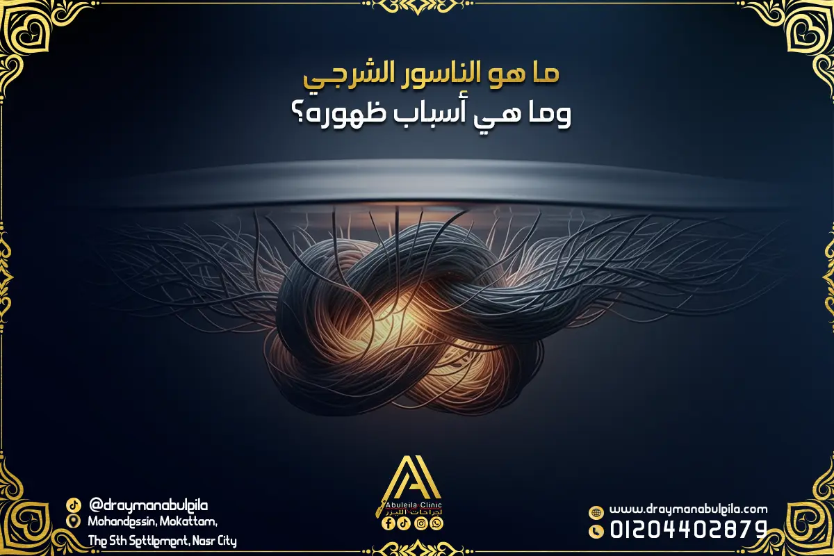 ما هو الناسور الشرجي وما هي أسباب ظهوره؟ 