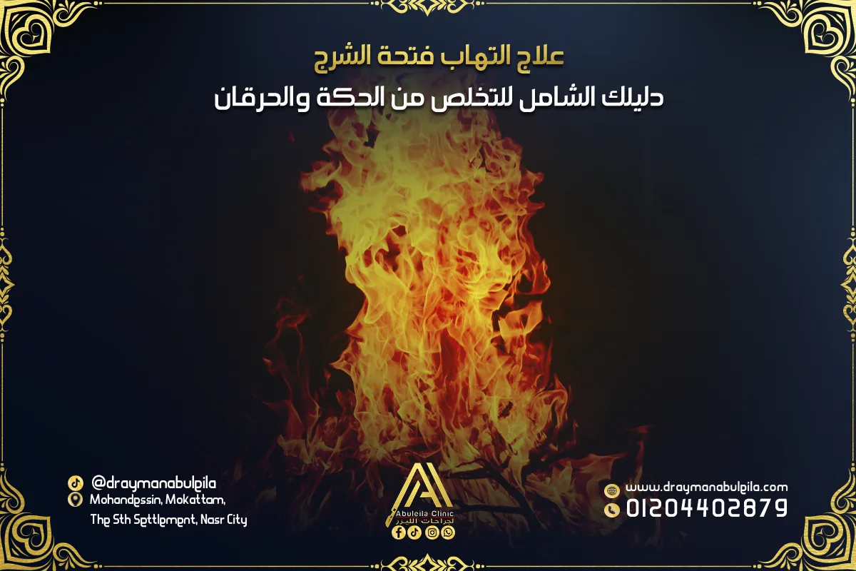 علاج التهاب فتحة الشرج: دليلك الشامل للتخلص من الحكة والحرقان