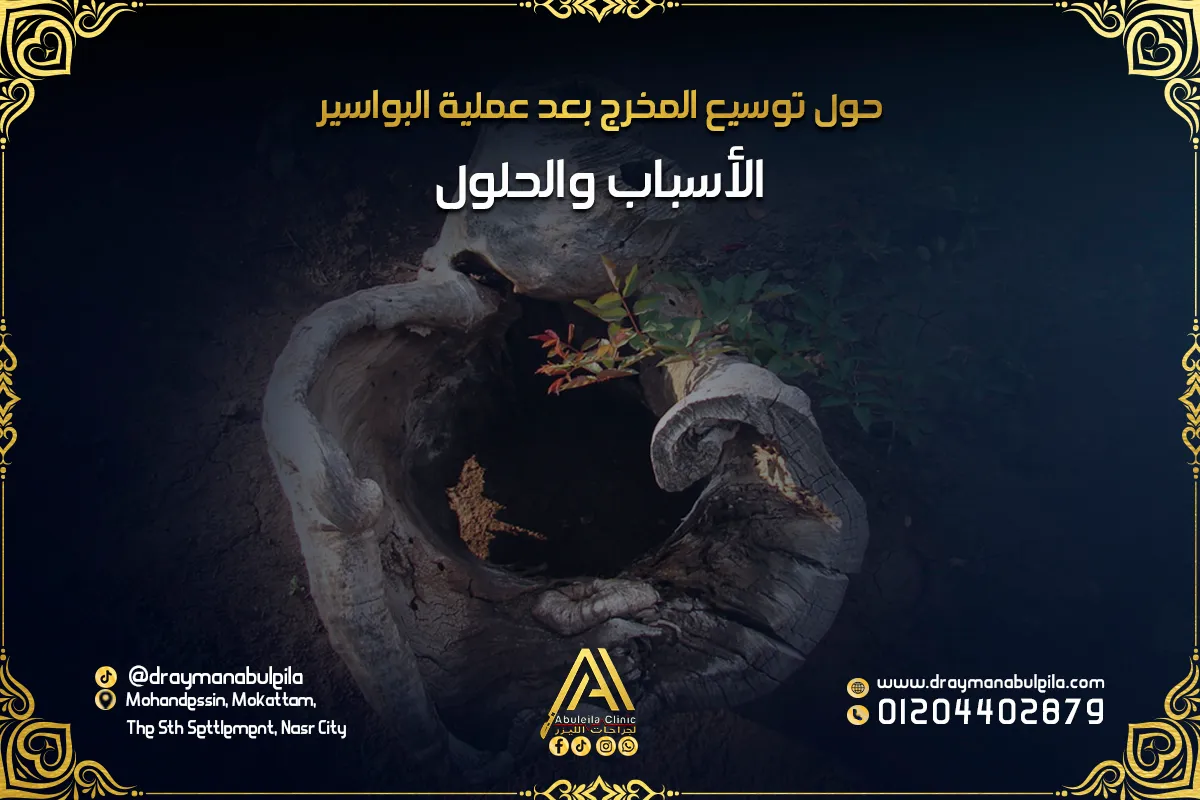 توسيع المخرج بعد عملية البواسير