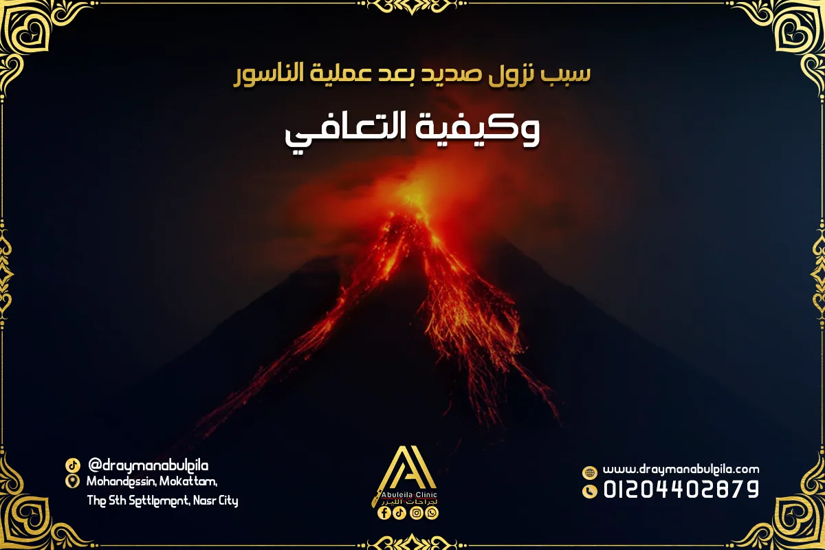  سبب نزول صديد بعد عملية الناسور وكيفية التعافي 