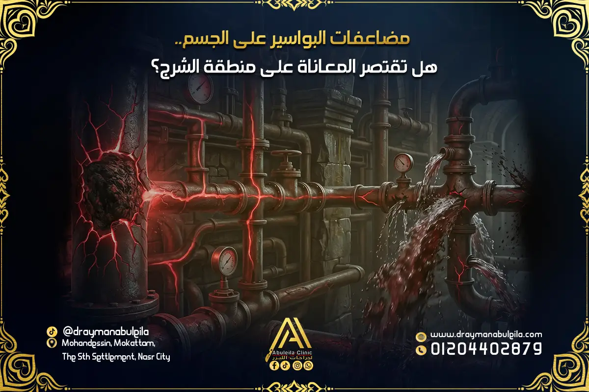 مضاعفات البواسير على الجسم هل تقتصر المعاناة على منطقة الشرج